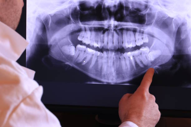 Best Walk-In Emergency Dental Services in Monroe, GA
